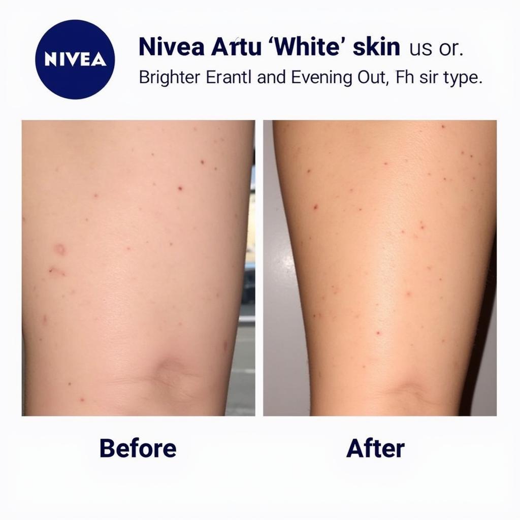 The results of using Nivea Extra White Serum deodorant